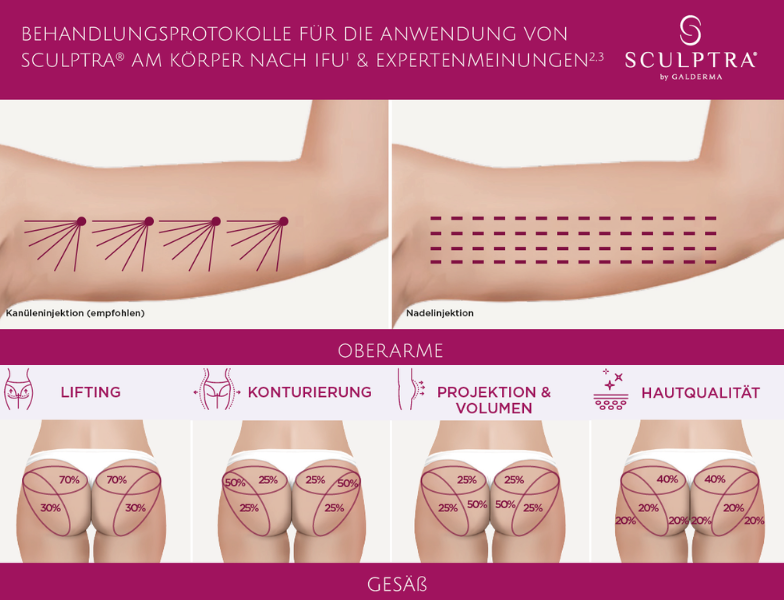 Was ist Sculptra®?