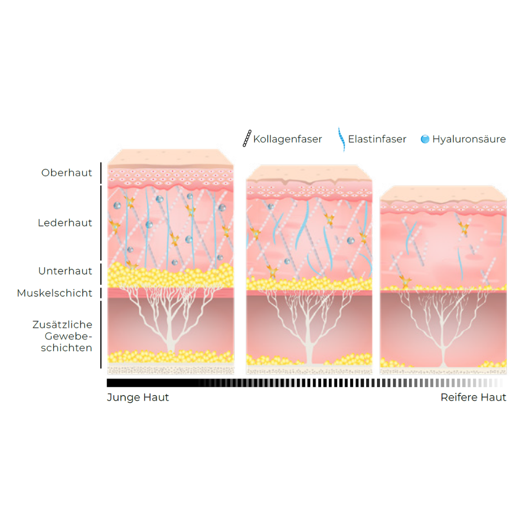 Was ist Ultherapy® Prime?